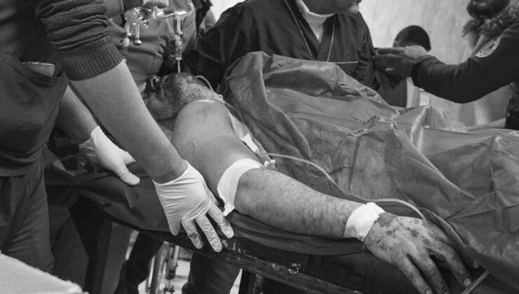 Terör örgütü YPG’nin Halep’teki saldırılarında 7 kişi öldü, 52 kişi yaralandı