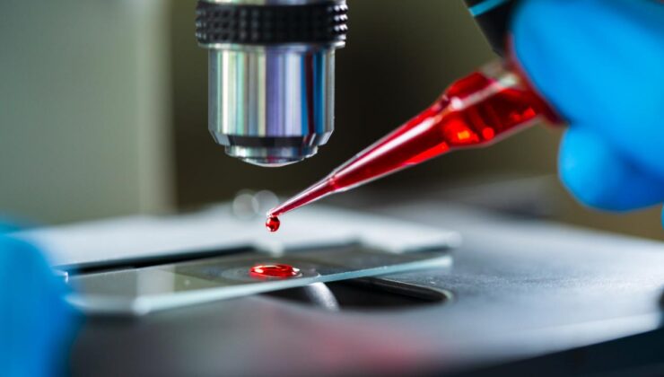 Türkiye’nin ilk yerli ve milli gen tedavisi için tarihi adım