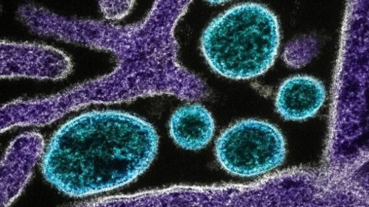 Sadece 5 enfeksiyon yılda 2 milyondan fazla yeni kanser vakasına neden oluyor